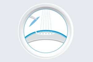 SMILE Pro as the third generation of laser eye surgery